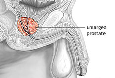 Cognitive impairment in prostate cancer patients receiving androgen deprivation therapy: A systematic review
