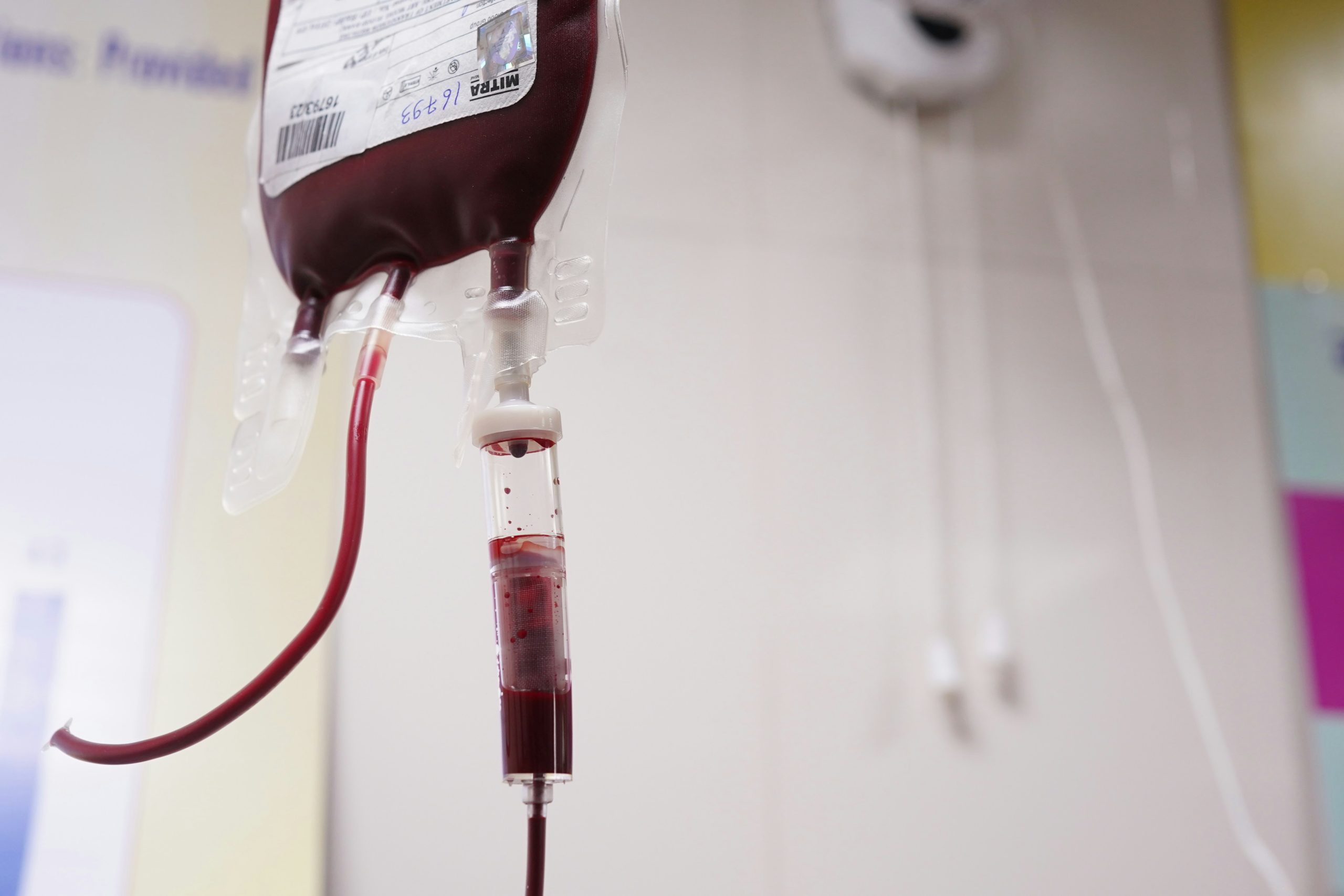 Adults with immune thrombocytopenia who transitioned to avatrombopag after previous treatment with eltrombopag or romiplostim.