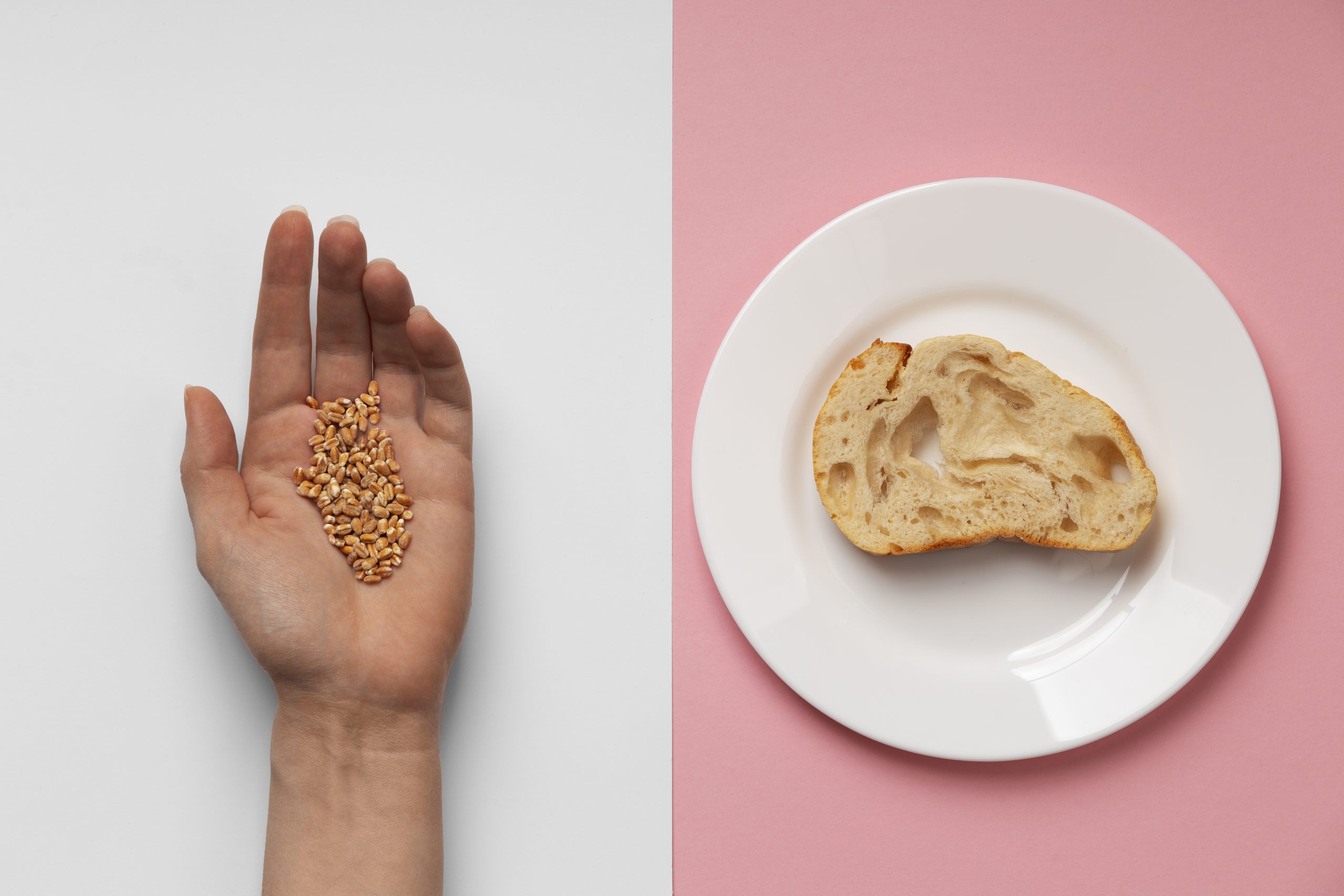 Epidemiological Investigation of Celiac Disease in Children: Prevalence, Risk Factors, and Dietary Impact